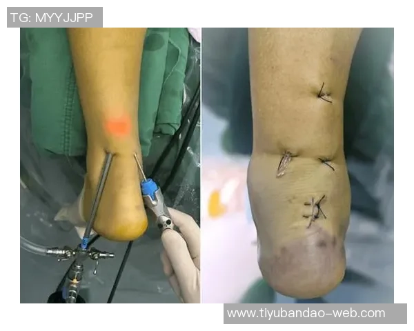 张佳玮点评爱德华兹技术提升背打急停变向对抗能力显著增强